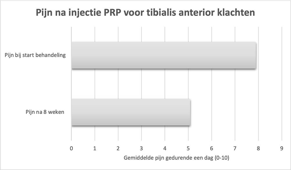 Pijn na injectie PRP voor tibialis anterior klachten