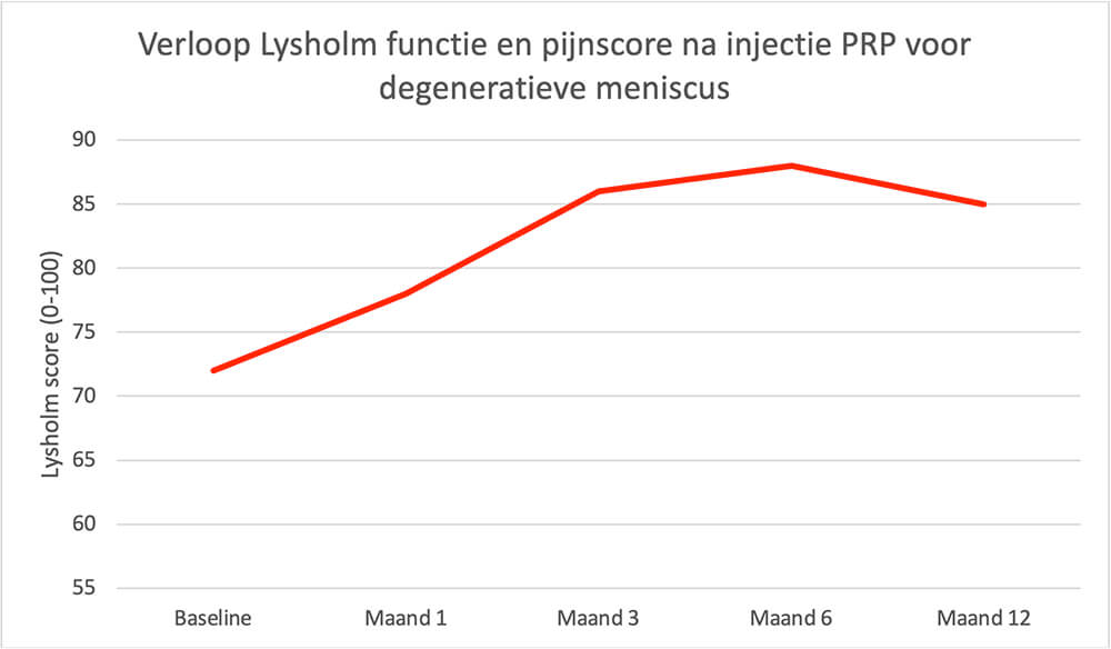 Verloop van de Lysholm functie en pijnscore na een injectie met PRP