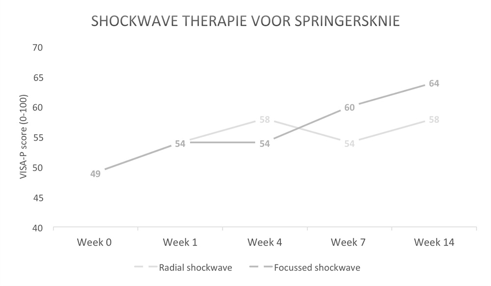 Shockwavetherapie bij een springersknie