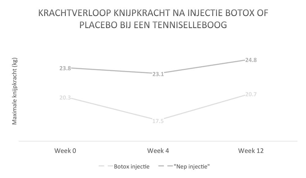 Verloop na injectie botox of placebo bij een tenniselleboog